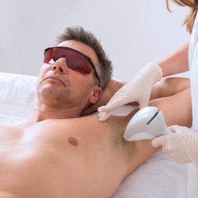 Laser-Hair-Removal-