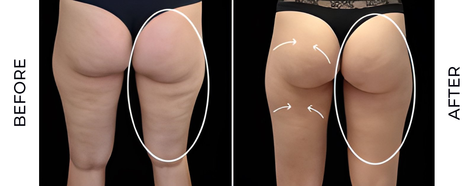 before-after-v1.jpg