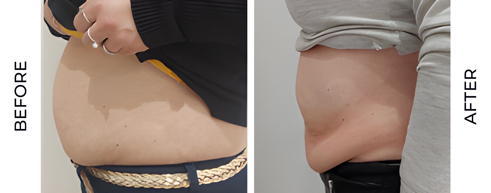 before-after-v2.jpg