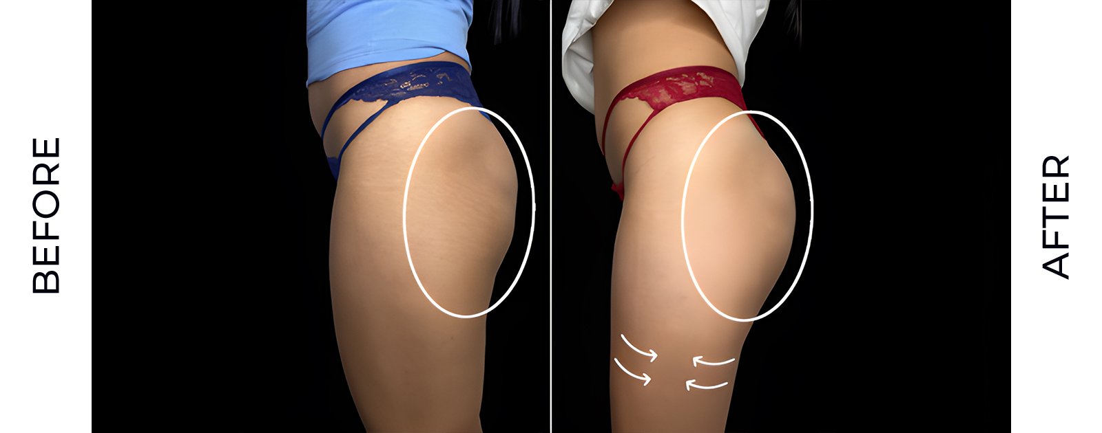 before-after-v3.jpg