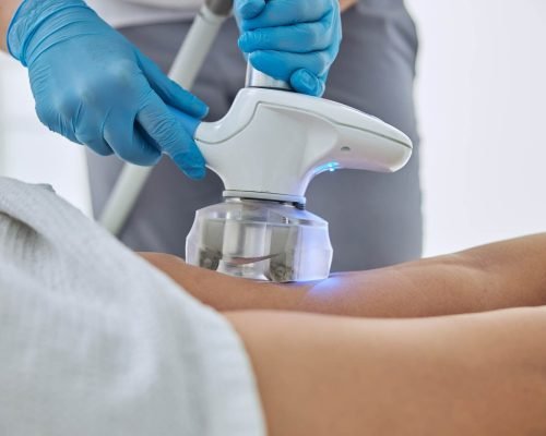 Unrecognized female client receiving anti-cellulite and anti-fat therapy in beauty clinic Cropped head portrait of beautician doing ultrasound cavitation body contouring treatment in wellness spa center